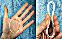 NuvaRing Contraceptive Ring Lawsuits