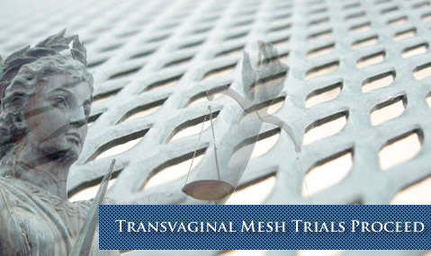 Transvaginal Mesh Lawsuits Proceed in Federal Court