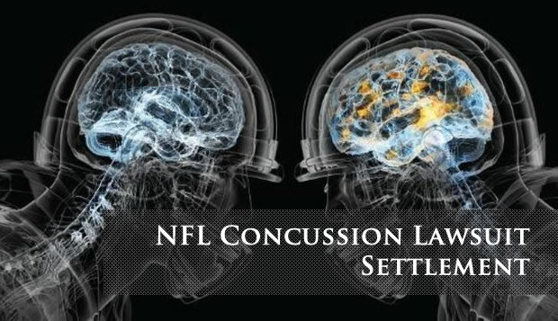 NFL Concussion Lawsuit Settlement