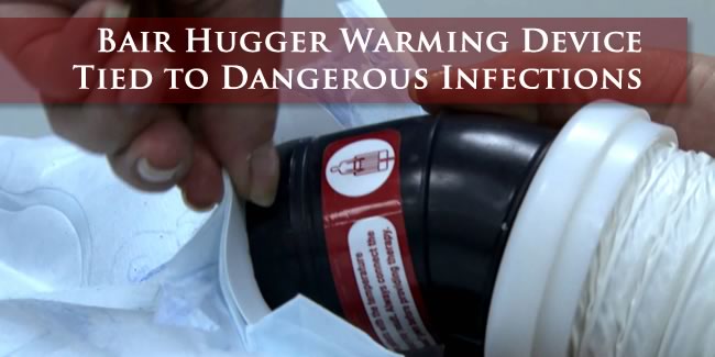 Bair Hugger Lawsuit