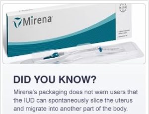 Mirena IUD Irresponsible Advertising Continues Despite Rising Lawsuits ...