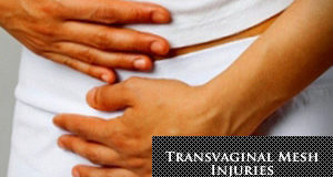 Transvaginal Mesh Common Injuries