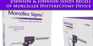 Johnson & Johnson Hysterectomy Device Recalled